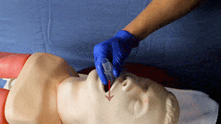 cwi-126-preparation-10-animated.gif