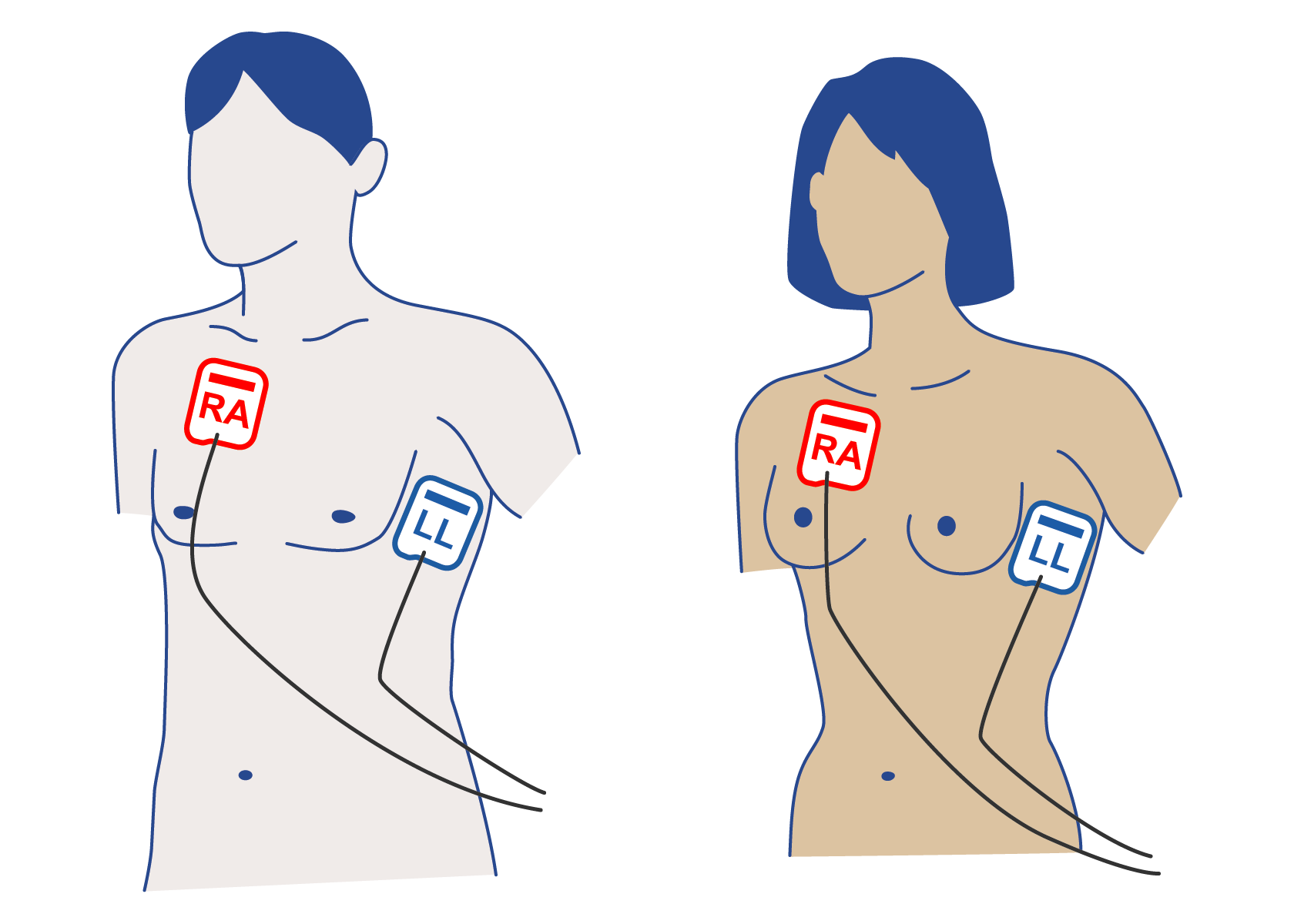 Defi-Anterior-Lateral.png